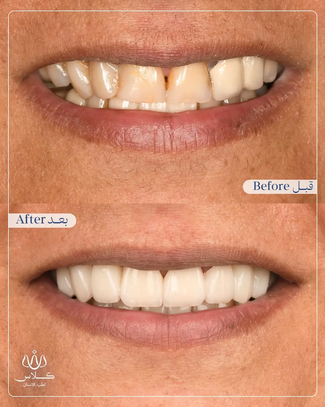 Before Image